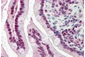 KPNA4 polyclonal antibody (5 ug/mL) staining of paraffin embedded human small intestine. (KPNA4 antibody  (C-Term))