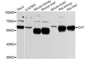 Western blot analysis of extracts of various cell lines, using CAT Antibody (ABIN5997374) at 1:3000 dilution. (Catalase antibody)