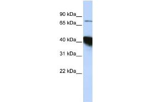 WB Suggested Anti-KIAA0427 Antibody Titration:  0. (CTIF/KIAA0427 antibody  (N-Term))