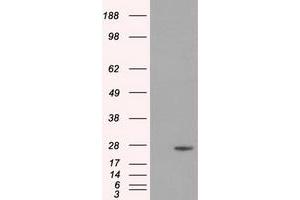 Image no. 4 for anti-Dicarbonyl/L-Xylulose Reductase (DCXR) antibody (ABIN1497785) (DCXR antibody)