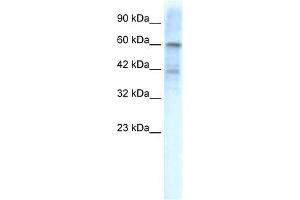 WB Suggested Anti-KCND3 Antibody Titration:  1. (KCND3 antibody  (Middle Region))