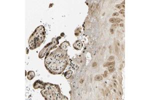 Immunohistochemical staining (Formalin-fixed paraffin-embedded sections) of human placenta with FGF3 polyclonal antibody  shows strong nuclear and cytoplasmic positivity in trophoblastic cells and moderate cytoplasmic positivity in decidual cells. (FGF3 antibody  (AA 102-223))