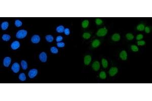 IF analysis of ACF1/BAZ1A using anti-ACF1/BAZ1A antibody (ABIN7599651). (BAZ1A antibody  (AA 1033-1536))