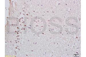 Formalin-fixed and rat brain tissue labeled with Anti-GTPBP10 Polyclonal Antibody (ABIN750748), Unconjugated at 1:200 followed by conjugation to the secondary antibody and DAB staining