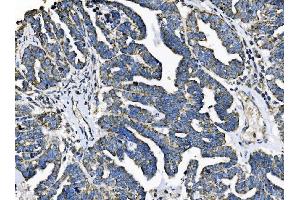 IHC analysis of TOMM70 using anti-TOMM70 antibody (ABIN7599855). (TOM70 antibody  (AA 122-608))