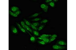 Immunofluorescent analysis of Hela cells using ABIN7168841 at dilution of 1:100 and Alexa Fluor 488-congugated AffiniPure Goat Anti-Rabbit IgG(H+L) (SENP6 antibody  (AA 1-270))
