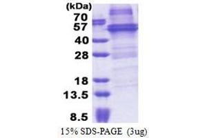 SDS-PAGE (SDS) image for RNA-Binding Protein NOB1 (NOB1) (AA 1-412) protein (His tag) (ABIN5853244)