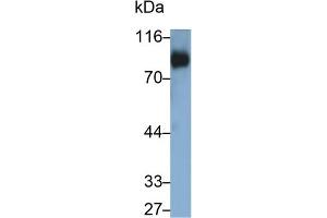 Detection of CD42d in Human Platelet lysate using Polyclonal Antibody to Cluster of Differentiation 42d (CD42d) (GP5 antibody  (AA 17-242))