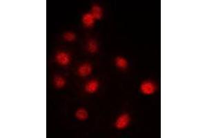 Immunofluorescent analysis of SNRP116 staining in NIH3T3 cells. (EFTUD2 antibody  (Center))