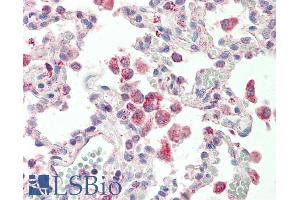 ABIN5539834 (5µg/ml) staining of paraffin embedded Human Lung. (GLRA1 antibody  (Internal Region))