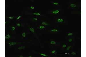 Immunofluorescence of monoclonal antibody to TGIF2 on HeLa cell. (TGIF2 antibody  (AA 114-175))