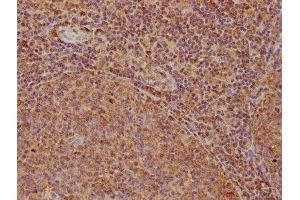 IHC image of ABIN7167999 diluted at 1:200 and staining in paraffin-embedded human tonsil tissue performed on a Leica BondTM system. (ROCK1 antibody  (AA 405-668))