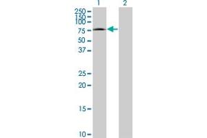 Western Blot analysis of CRSP7 expression in transfected 293T cell line by CRSP7 monoclonal antibody (M06), clone 2G10. (MED26 antibody  (AA 501-600))