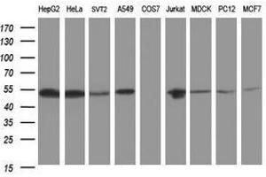 Image no. 3 for anti-CD2 (CD2) antibody (ABIN1497194) (CD2 antibody)
