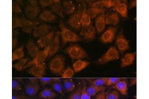 Immunofluorescence analysis of HeLa cells using MYO6 Polyclonal Antibody at dilution of 1:100. (Myosin VI antibody)