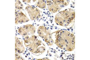 Immunohistochemistry of paraffin-embedded human normal stomach using CHIT1 antibody. (Chitotriosidase 1 antibody)