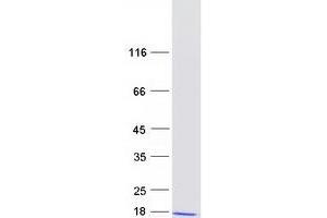 Western Blotting (WB) image for Dynein, Axonemal, Light Chain 4 (DNAL4) protein (Myc-DYKDDDDK Tag) (ABIN2719611)