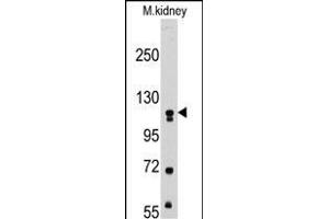 Western blot analysis of anti-MUSK Pab (ABIN392021 and ABIN2841797) in mouse kidney tissue lysates (35 μg/lane). (MUSK antibody)