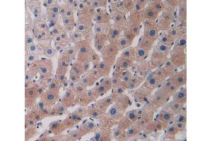 IHC-P analysis of human liver tissue, with DAB staining. (CCL5 antibody  (AA 24-91))