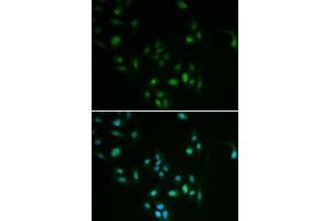 Immunofluorescence analysis of MCF7 cell using BCL2 antibody. (Bcl-2 antibody)