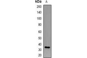 Western blot analysis of CD158i expression in HEK293T (A) whole cell lysates.