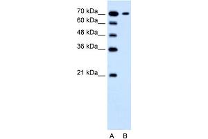 WB Suggested Anti-SLC5A4 Antibody Titration:  1. (SLC5A4 antibody  (N-Term))