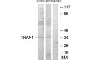 Western blot analysis of extracts from HuvEc cells, treated with PMA 125ng/ml 30', using TNAP1 Antibody. (TNFAIP1 antibody  (AA 71-120))