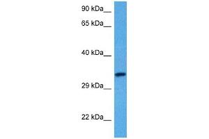 Host:  Rabbit  Target Name:  SLC29A3  Sample Tissue:  Human Uterus Tumor lysates  Antibody Dilution:  1ug/ml (SLC29A3 antibody  (C-Term))