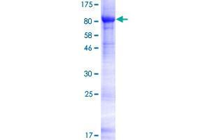 ACRBP Protein (AA 1-543) (GST tag)