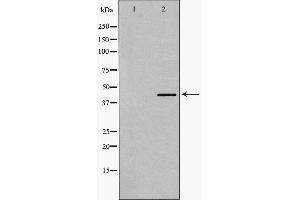 Western blot analysis of Smad7 expression in Human Kidney lysate,The lane on the left is treated with the antigen-specific peptide. (SMAD7 antibody  (N-Term))
