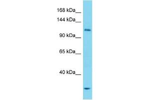 Western Blotting (WB) image for anti-Unc-51 Like Kinase 1 (ULK1) (N-Term) antibody (ABIN2785618) (ULK1 antibody  (N-Term))