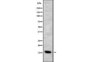 Western blot analysis of CYB5B expression in HEK293 cells ,The lane on the left is treated with the antigen-specific peptide.