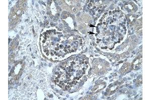 Lipase antibody (Pancreatic) was used for immunohistochemistry at a concentration of 4-8 ug/ml to stain Epithelial cells of renal corpuscle (lndicated with Arrows) in Human Kidney. (Lipase (C-Term) antibody)