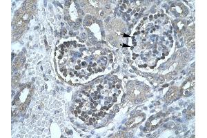 Lipase antibody (Pancreatic) was used for immunohistochemistry at a concentration of 4-8 ug/ml to stain Epithelial cells of renal corpuscle (lndicated with Arrows) in Human Kidney. (PNLIP antibody  (C-Term))