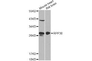 Western blot analysis of extracts of various cell lines, using RPP30 antibody (ABIN6290883) at 1:1000 dilution. (RPP30 antibody)