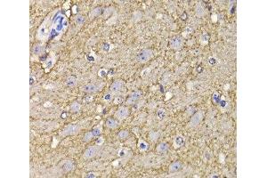 Immunohistochemistry of paraffin-embedded Mouse brain using KCND3 Polyclonal Antibody at dilution of 1:100 (40x lens). (KCND3 antibody)