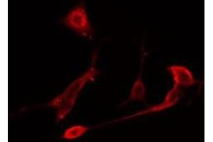 ABIN6275758 staining  NIH-3T3 cells by IF/ICC. (DUSP10 antibody  (Internal Region))