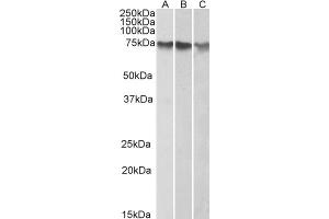 ABIN184639 (1µg/ml) staining of HepG2 (A), K562 (B) and HeLa (C) nuclear lysates (35µg protein in RIPA buffer). (ATF2 antibody  (C-Term))
