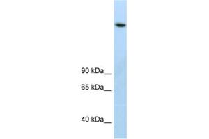 Western Blotting (WB) image for anti-Lysine (K)-Specific Demethylase 3B (KDM3B) antibody (ABIN2461878) (KDM3B antibody)
