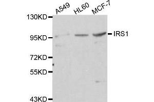 Western blot analysis of extracts of various cell lines, using IRS1 antibody. (IRS1 antibody)