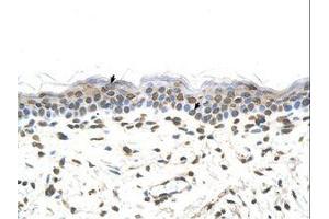 Image no. 1 for anti-Formiminotransferase Cyclodeaminase (FTCD) (N-Term) antibody (ABIN320656) (FTCD antibody  (N-Term))