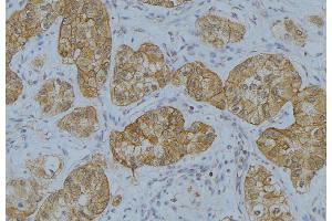 ABIN6273650 at 1/100 staining Human uterus tissue by IHC-P. (IL-13 antibody  (N-Term))