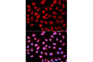 Immunofluorescence analysis of U2OS cells using PPP2R4 antibody (ABIN5970981). (PPP2R4 antibody)