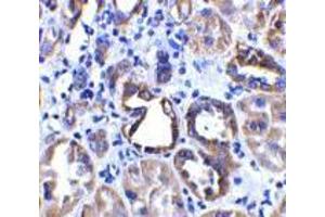 Immunohistochemistry of ACE2 in human kidney tissue with ACE2 antibody at 2 μg/ml. (ACE2 antibody  (Intermediate Domain 2))