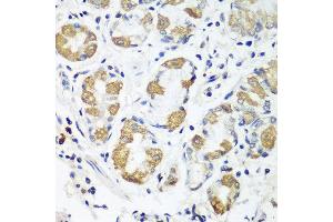 Immunohistochemistry of paraffin-embedded human stomach using OXCT1 antibody at dilution of 1:100 (40x lens). (OXCT1 antibody)