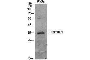 HSD11B1 antibody  (Internal Region)