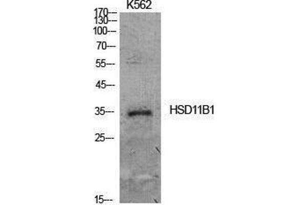 HSD11B1 antibody  (Internal Region)