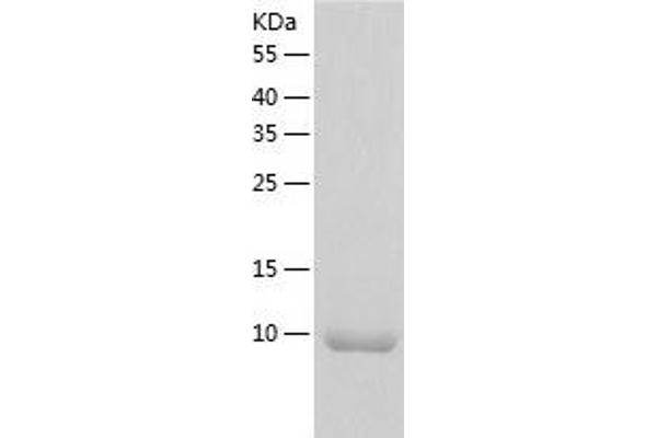 LAMTOR4 Protein (AA 1-99) (His tag)