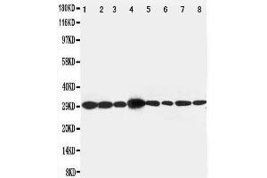 Western Blotting (WB) image for anti-LIM and SH3 Protein 1 (LASP1) (AA 16-30), (N-Term) antibody (ABIN3044177)