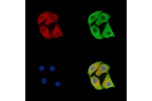 ABIN7096364 and ABIN7100427 staining Hela cells by IF/ICC.